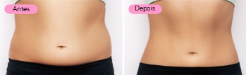 Antes e depois