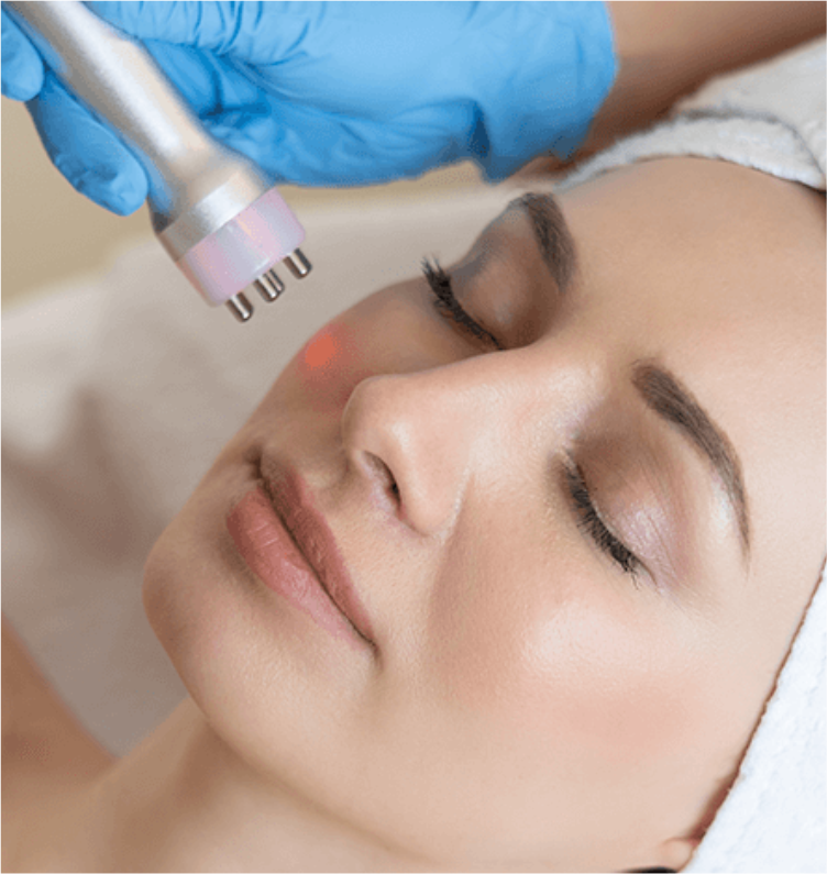 Radiofrequência Facial